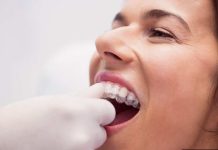 Bruxismo: Una causa de la pérdida de piezas dentales
