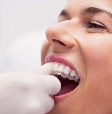 Bruxismo: Una causa de la pérdida de piezas dentales